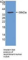 Very Low Density Lipoprotein Receptor (VLDLR) Antibody
