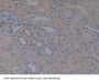 Very Low Density Lipoprotein Receptor (VLDLR) Antibody