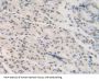 Non-Histone Chromosomal Protein HMG-17 (HMGN2) Antibody