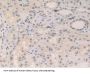 Non-Histone Chromosomal Protein HMG-17 (HMGN2) Antibody