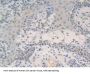 Non-Histone Chromosomal Protein HMG-17 (HMGN2) Antibody