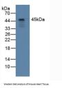 Squamous Cell Carcinoma Antigen 1 Antibody