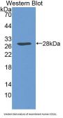 Squamous Cell Carcinoma Antigen 1 Antibody