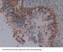 Squamous Cell Carcinoma Antigen 1 Antibody
