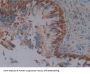 Squamous Cell Carcinoma Antigen 1 Antibody