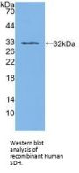 Sorbitol Dehydrogenase (SDH) Antibody