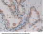 Sorbitol Dehydrogenase (SDH) Antibody