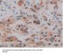 Sorbitol Dehydrogenase (SDH) Antibody