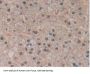 Sorbitol Dehydrogenase (SDH) Antibody