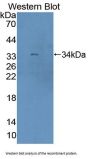 Rap Guanine Nucleotide Exchange Factor 1 (RAPGEF1) Antibody
