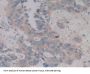 Mitogen Activated Protein Kinase Kinase 6 (MAP2K6) Antibody