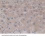 Mitogen Activated Protein Kinase Kinase 6 (MAP2K6) Antibody