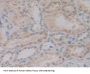 Mitogen Activated Protein Kinase Kinase 6 (MAP2K6) Antibody