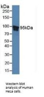 Signal Transducer And Activator of Transcription 5B (STAT5B) Antibody