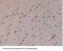 Signal Transducer And Activator of Transcription 5B (STAT5B) Antibody