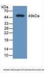 Calumenin (CALU) Antibody