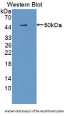 Laminin Gamma 2 (LAMC2) Antibody