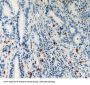 Laminin Gamma 2 (LAMC2) Antibody