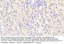 Tight Junction Protein ZO-1 (TJP1) Antibody