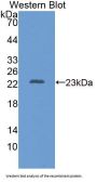 Induced Myeloid Leukemia Cell Differentiation Protein (MCL1) Antibody