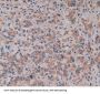 Microfibrillar Associated Protein 2 (MFAP2) Antibody
