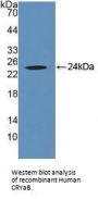 Crystallin Alpha B (CRYaB) Antibody