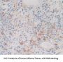 Crystallin Alpha B (CRYaB) Antibody