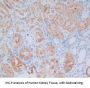 Crystallin Alpha B (CRYaB) Antibody