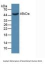 Dickkopf Related Protein 3 (DKK3) Antibody