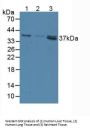 5'-Nucleotidase, Cytosolic III (NT5C3) Antibody