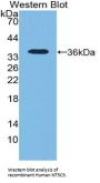 5'-Nucleotidase, Cytosolic III (NT5C3) Antibody