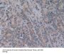 5'-Nucleotidase, Cytosolic III (NT5C3) Antibody