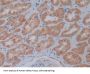 5'-Nucleotidase, Cytosolic III (NT5C3) Antibody