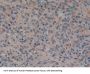 Pancreatic secretory granule membrane major glycoprotein GP2 (GP2) Antibody