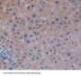 Pancreatic secretory granule membrane major glycoprotein GP2 (GP2) Antibody