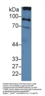 Inter alpha Globulin Inhibitor H2 Antibody