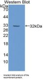 Inter alpha Globulin Inhibitor H2 Antibody