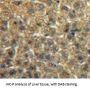 Inter alpha Globulin Inhibitor H2 Antibody