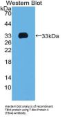 T-Box Protein 4 (TBX4) Antibody