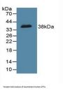 DNA Fragmentation Factor Subunit Alpha (DFFa) Antibody