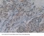 DNA Fragmentation Factor Subunit Alpha (DFFa) Antibody
