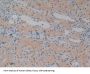 DNA Fragmentation Factor Subunit Alpha (DFFa) Antibody
