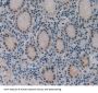 DNA Fragmentation Factor Subunit Alpha (DFFa) Antibody