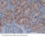 Apoptosis Regulatory Protein Siva / CD27BP (SIVA1) Antibody