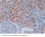 Apoptosis Regulatory Protein Siva / CD27BP (SIVA1) Antibody