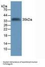 Tomoregulin (TR) Antibody