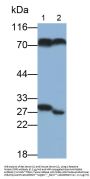 C Reactive Protein (CRP) Antibody