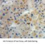 Angiogenin (ANG) Antibody