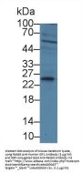 Insulin Like Growth Factor 1 (IGF1) Antibody