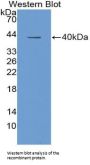 Insulin Like Growth Factor 1 (IGF1) Antibody